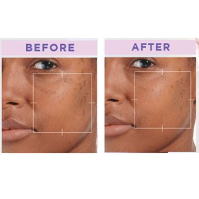 L'Oréal Paris Glycomplete Day Kit, Glycolic Bright Cleanser 100ml+ Day Cream 50ml +Serum 30ml