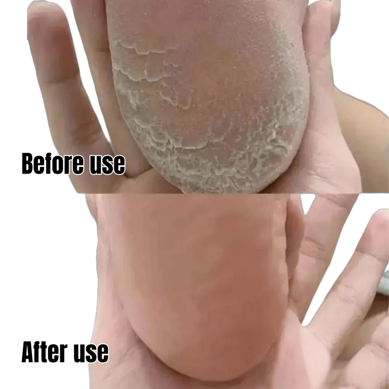 KORMESIC Vaseline Nourish Repair Foot Cream – Repair Dry Cracked Heels Soften Calluses Dead Skin Non-Greasy Hydrating Dry Feet Smooth Brighten Foot Skin Sooth Moisturizes & Nourishes Overnight Repair