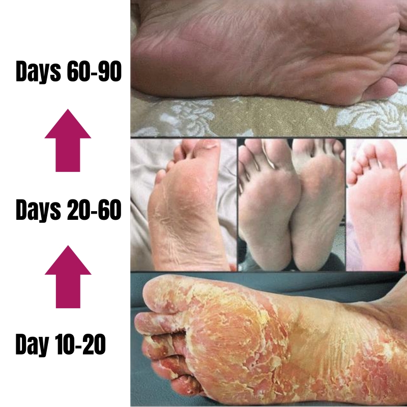 KORMESIC Vaseline Nourish Repair Foot Cream – Repair Dry Cracked Heels Soften Calluses Dead Skin Non-Greasy Hydrating Dry Feet Smooth Brighten Foot Skin Sooth Moisturizes & Nourishes Overnight Repair