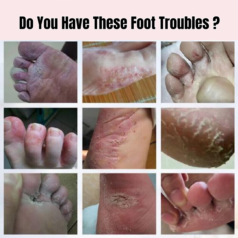 KORMESIC Vaseline Nourish Repair Foot Cream – Repair Dry Cracked Heels Soften Calluses Dead Skin Non-Greasy Hydrating Dry Feet Smooth Brighten Foot Skin Sooth Moisturizes & Nourishes Overnight Repair