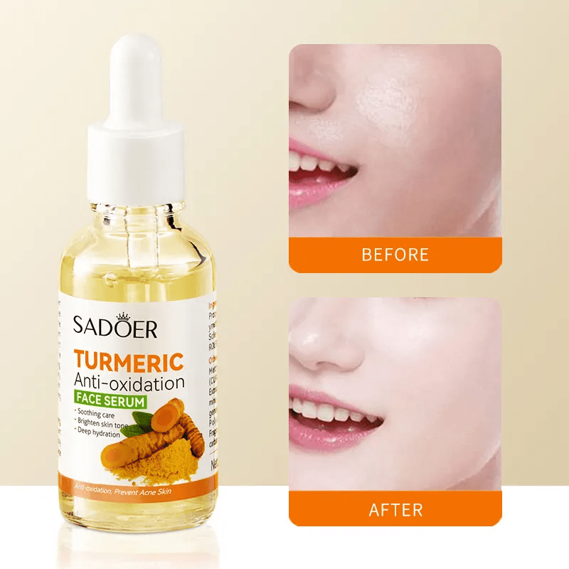 SADOER 5 in 1 Turmeric Set, Tumeric Cleanser + Turmeric Serum + Tumeric Cream + Vitamin C Lipbalm Moisturizing Lip Balm + Blackheads Removal Peel Off Mask, Anti Oxidation, Moisturizing, Anti Acne