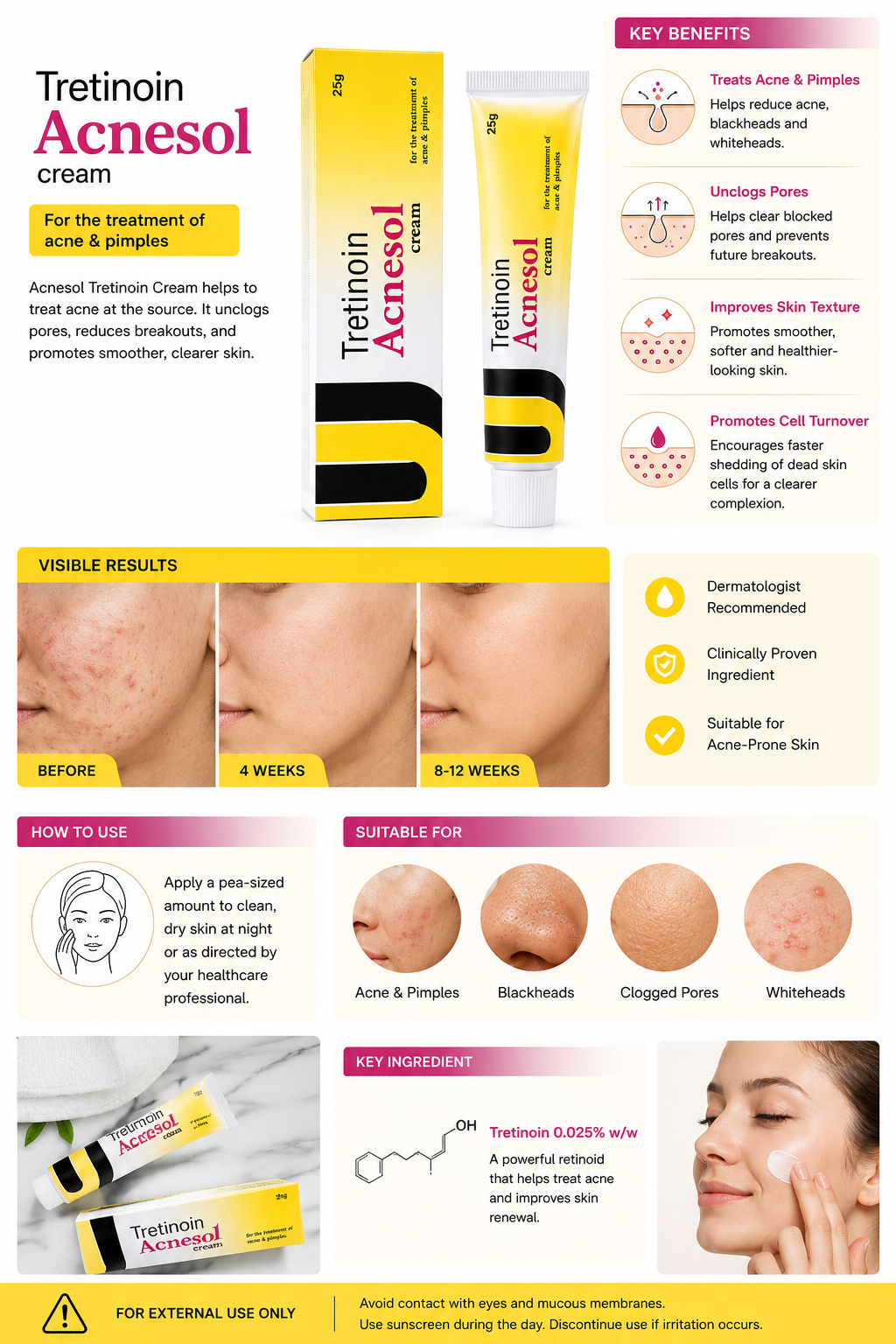 Acnesol Tretinoin Cream 25g – Acne & Pimples Treatment Retinoid Cream for Clearer Skin