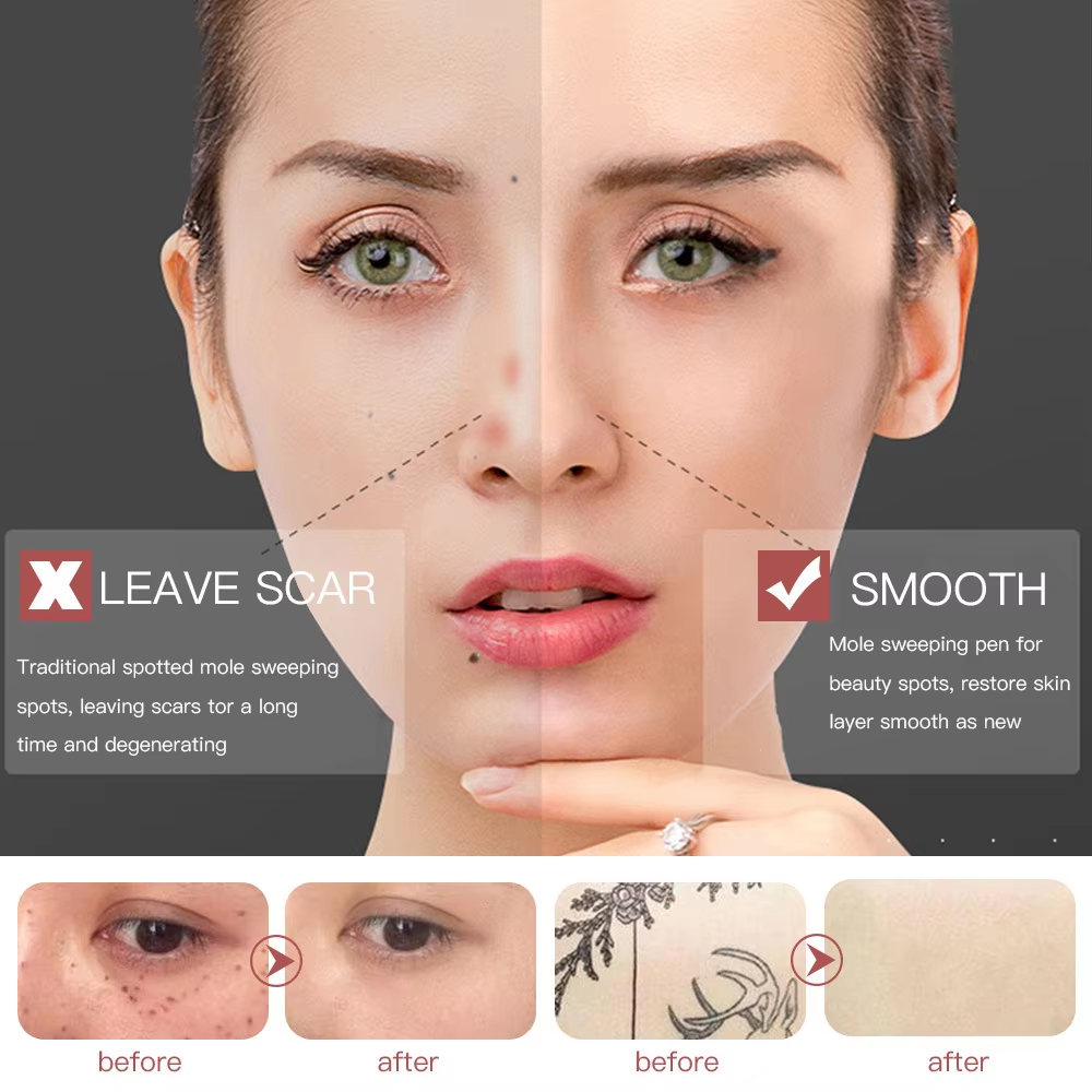 Portable Professional 9-Speed Face Laser Plasma Pen Machine Facia Beauty Skin Care