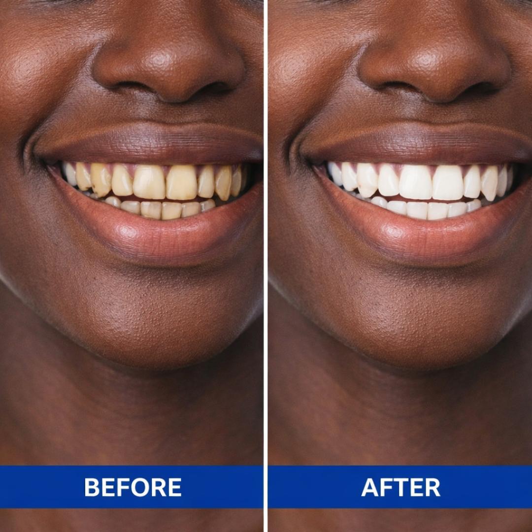 5D Teeth Whitening Strips Professional Dental Whitening Strips for Stain Removal Bright Smile Oral Care Kit