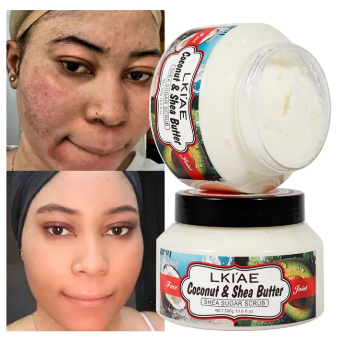 LKIAE Foaming Body Scrub 300g with Shea Butter, Coconut Oil and Coconut Milk for Exfoliating, Moisturizing and Brightening Skin