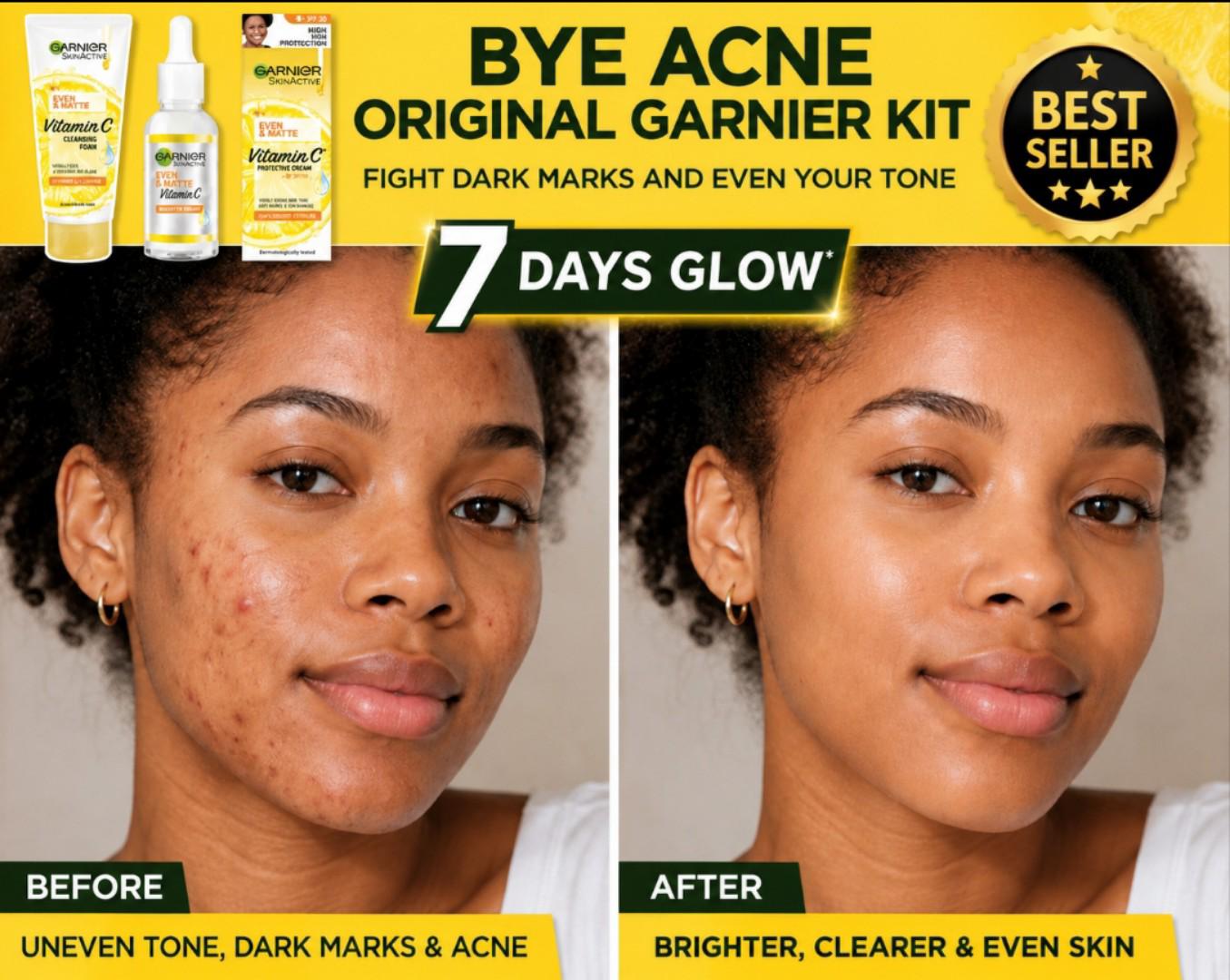[ORIGINAL] Garnier Vitamin C Skin Care Set– Bye Acne, Remove Dark Marks & Get 7 Days Glow. Cleansing Foam 50ml, Serum 15ml and SPF 30 50ml.[DISCOUNTED]
