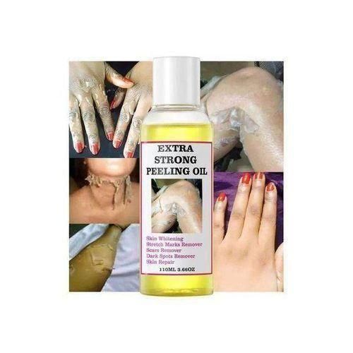 Extra Strong Peeling Oil, Peeling Oil for Dark Skin, Yellow Peeling Oil, Exfoliating Peeling Solution for Hand Feet, Chemical Peel for Face
