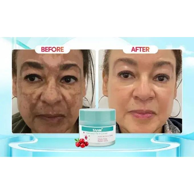 SAAM. Renewal Face Cream – All-in-One Solution for Melasma & Freckles