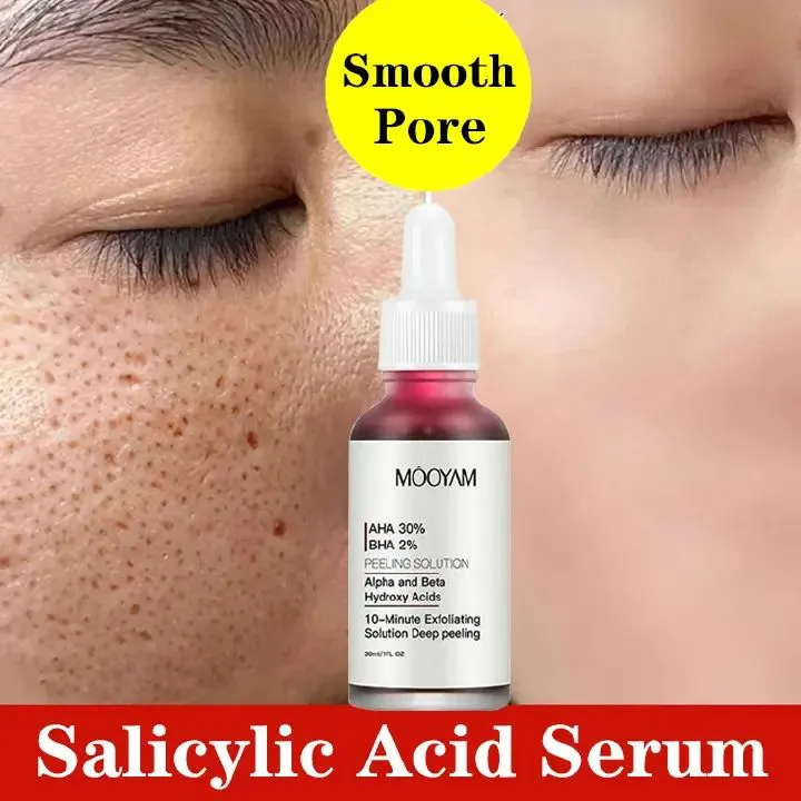AHA 30% + BHA 2% Peeling Solutions, 30% AHA Glycolic Acid Peel With Lactic Acid Aloe Vera, Facial Exfoliator Exfoliating Peel Serum For Acne Pimple Spot 1 Fl Oz - MOOYAM