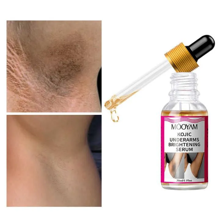 Body Whitening Underarms Armpits Whitening Kojic Acid Serum Bleach Brightening Underarm Elbow Knees Joint Removal Intimate Parts Dark Spots Melanin Snow Bleach Cream 30ml - MOOYAM