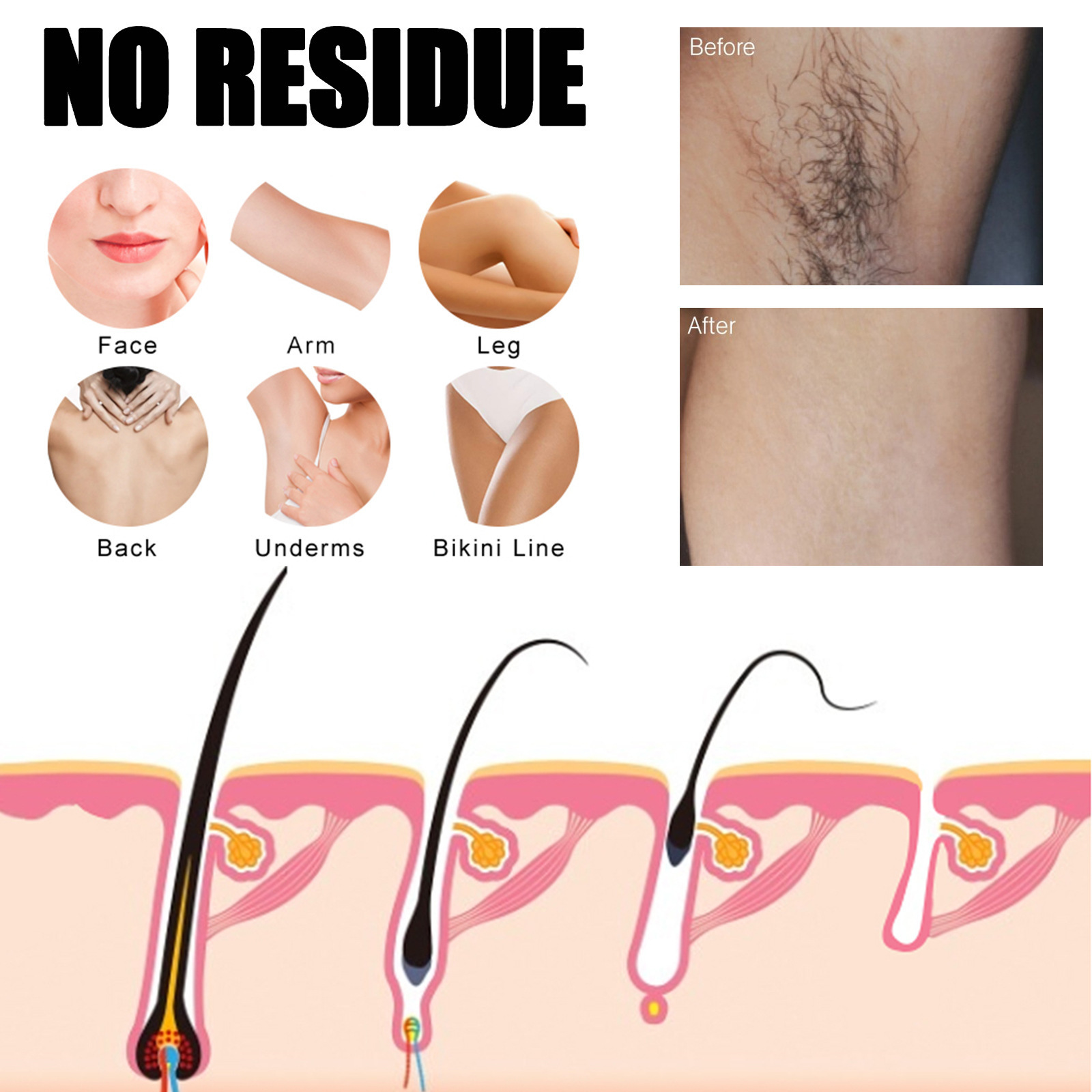 Hair Removal Spray Permanant Inhibitor Armpit Legs Arms Painless Beard Bikini Intimate Facial Hair Removal For Man Women