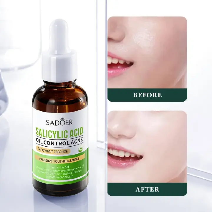 Sadoer 5 Pieces, Vitamin C Face Serum + AHA BHA Serum + Niacinamide Face Brightening + Retinol Caffeine Serum + Salicylic Acid Serum Oil Control, Face Brightening, Anti Aging, Anti Wrinkles