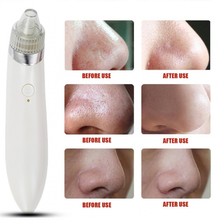 Blackhead Remover Blackhead Vacuum Suction Remover Electric Facial Pore Cleanser