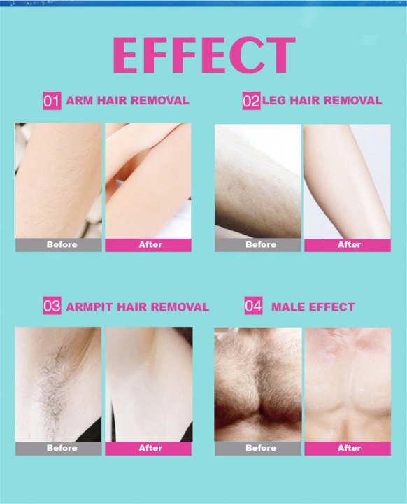 10pcs Summer Professional Hair Removal Double Sided Cold Wax Strips Paper For Leg Body Fac