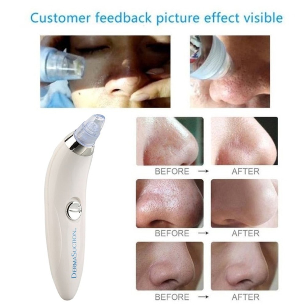 Blackhead Remover T Zone Pore Acne Pimple Removal Face Deep Nose Cleaner Beauty Clean Skin