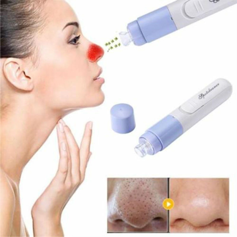 Mini Electric Facial Pore Blackhead Cleanser Skin Cleaner Face Dirt Suck Up Vacuum Tool LQS