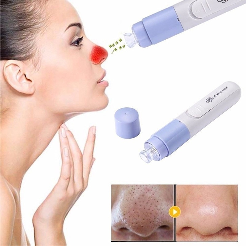 Blackheads Vacuum Cleaner Cleaner Pore Remover Skin Electric Cleanser Face Tool