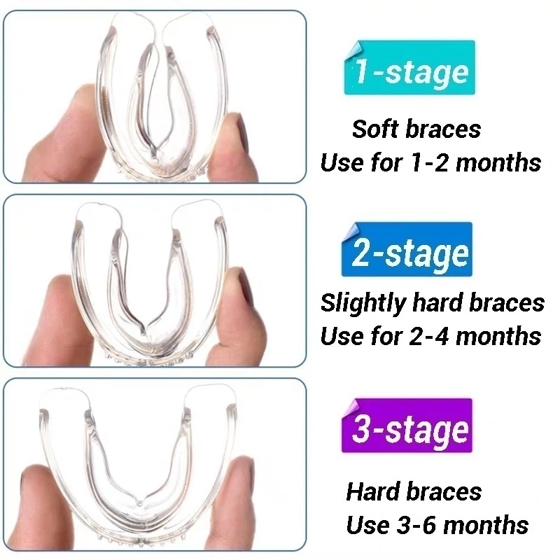 3 Stages Dental Orthodontic Teeth Corrector Braces Tooth Retainer Straighten Tools Adult Child