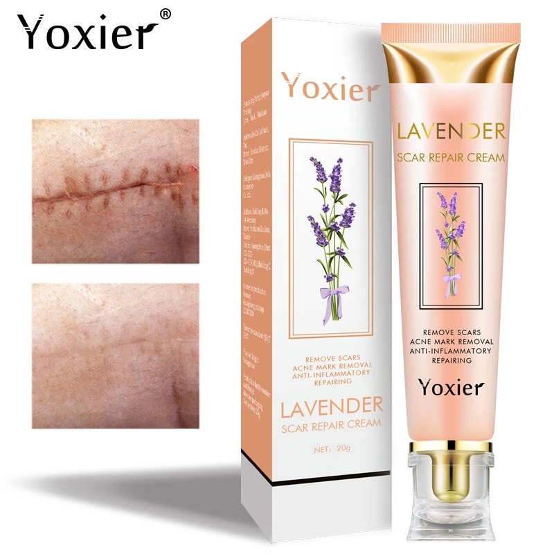 Cream Repairing Removing Burn Scars Promote Cell Regeneration Enhance Elasticity Cucumber Skin Care