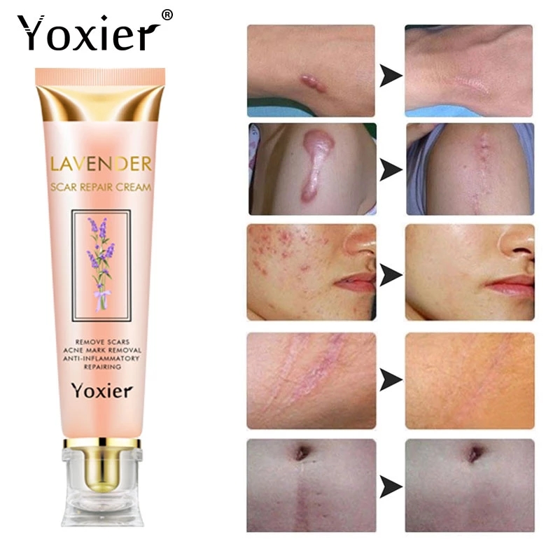 Cream Repairing Removing Burn Scars Promote Cell Regeneration Enhance Elasticity Cucumber Skin Care