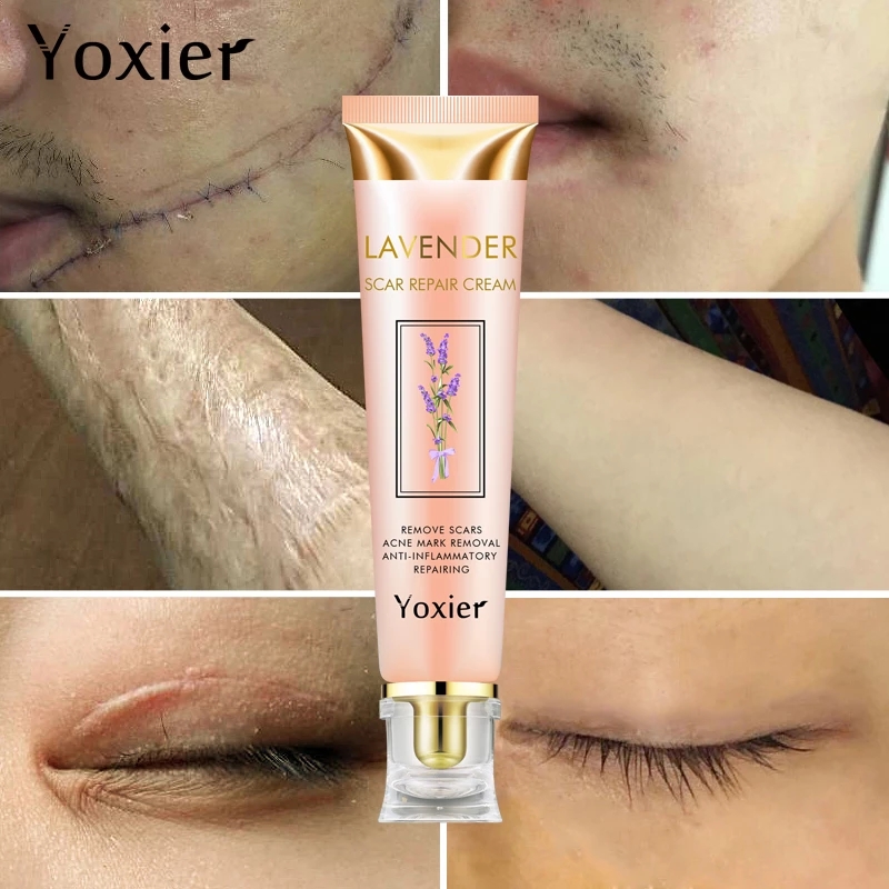 Cream Repairing Removing Burn Scars Promote Cell Regeneration Enhance Elasticity Cucumber Skin Care