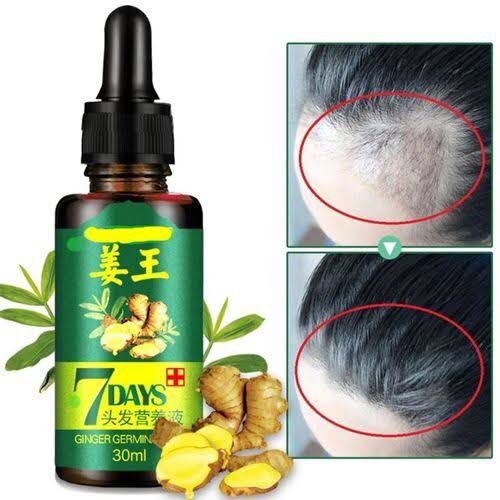 O carly ginger hair growth serum plus free Hair now now serum