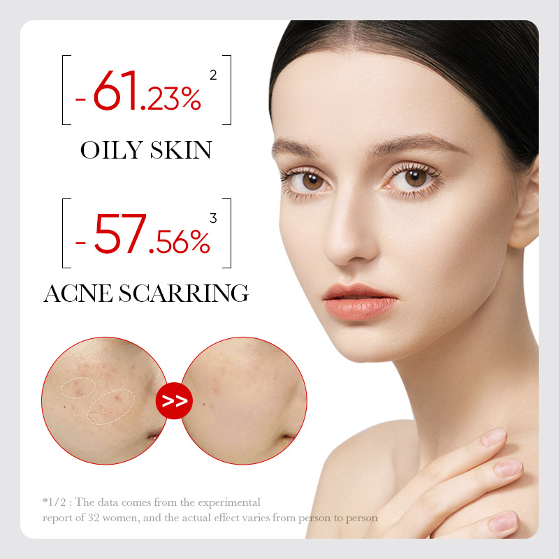 5 in 1 Face Serums Combo, Vitamin C Face Brightening Serum +  Tumeric Face Serum + Retinol Eye Essence + Acne Repair Serum + Anti-Hairloss Treatment Essence, Fade Dark Spots, An 5 Serums Combo