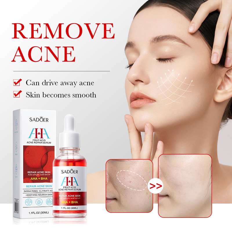 AHA + BHA Fruit Acid Acne Repair Serum, With Salicylic Acid , Shrinks Pores, Eliminates Acne, Nourish and Smoothens Skin, Repair Acne Marks, Can Combine with Vitamin C, Mois 30ml