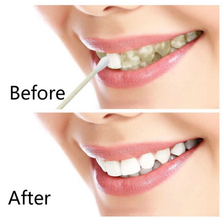 Teeth Whitening Quick Effect to Yellow Dental Plaque Dental Tattoo Black Stained Toothpaste Liquid