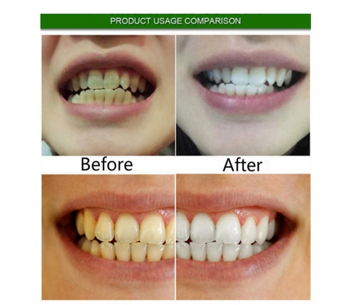 Teeth Whitening Quick Effect to Yellow Dental Plaque Dental Tattoo Black Stained Toothpaste Liquid