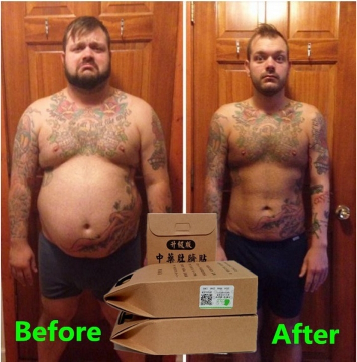 Slimming Diets Weight Loss 40x Strongest Slim Patch Pads Detox Adhesive Sheet