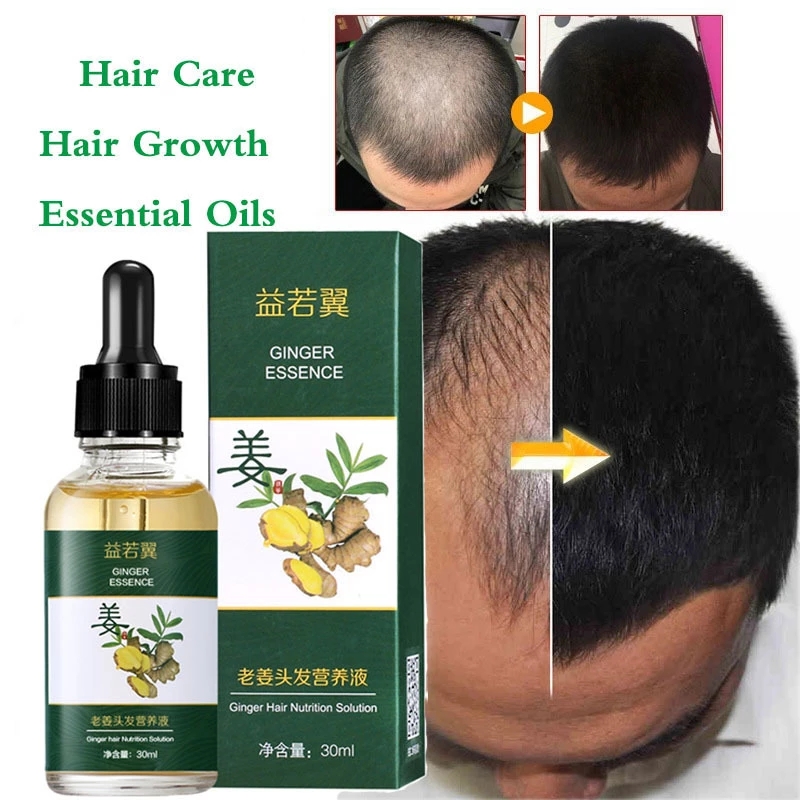 Powerful Hair Growth Ginger Extract Essential Oil Treatment Anti Hair Loss Hair Care Serum