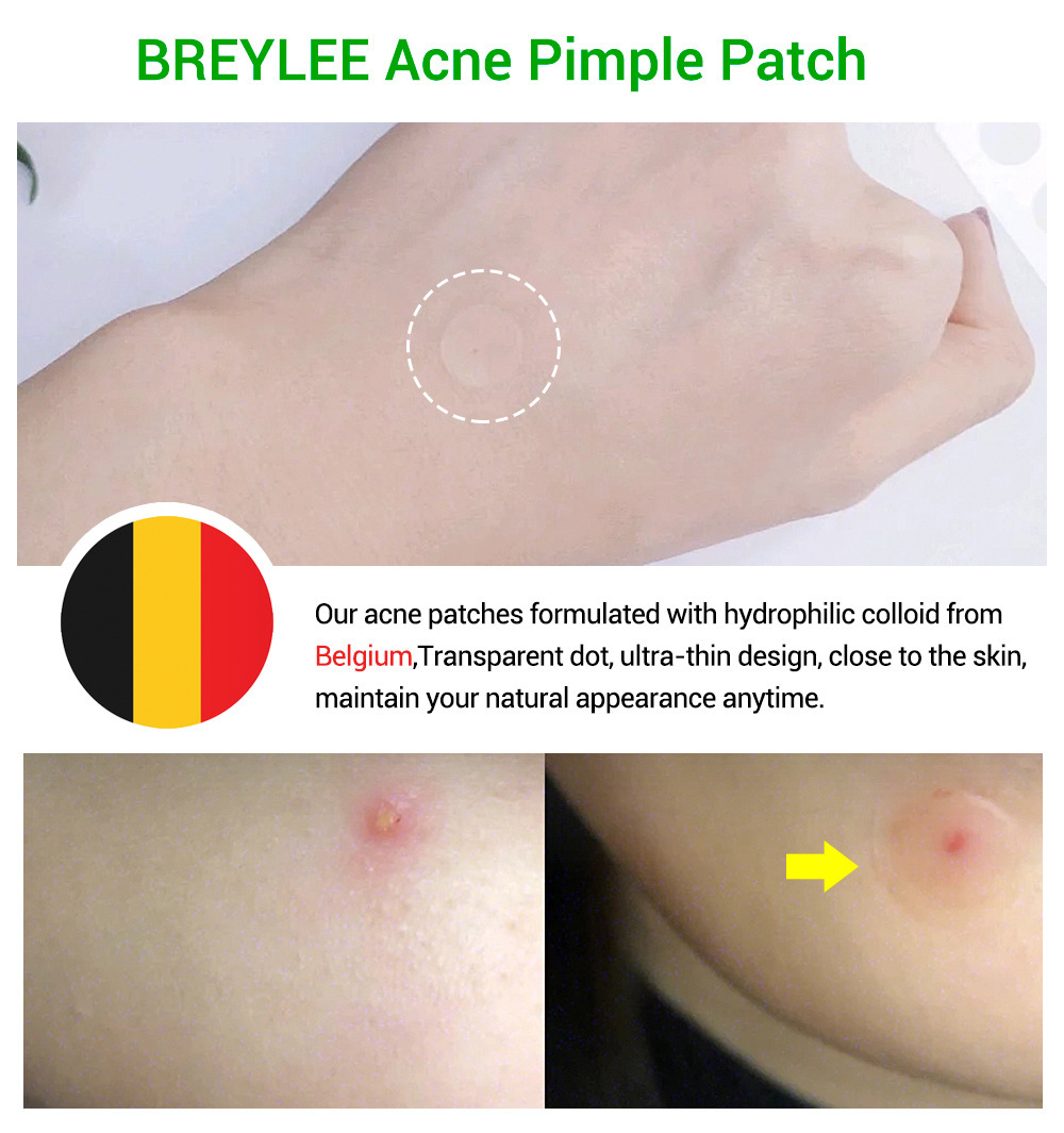42Pcs Acne Pimple Patch Face Mask Skin Care Acne Treatment Serum Face Cream Acne Pimples Remover