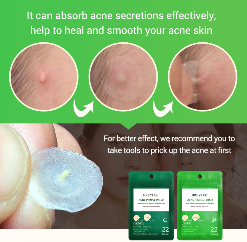 42Pcs Acne Pimple Patch Face Mask Skin Care Acne Treatment Serum Face Cream Acne Pimples Remover