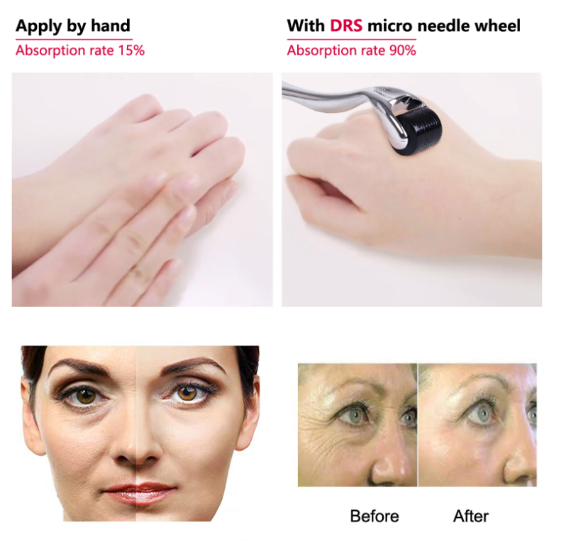 Sales 540 Derma Roller Micro Needles Titanium Mezoroller Microneedle Machine Skin Care Body Care