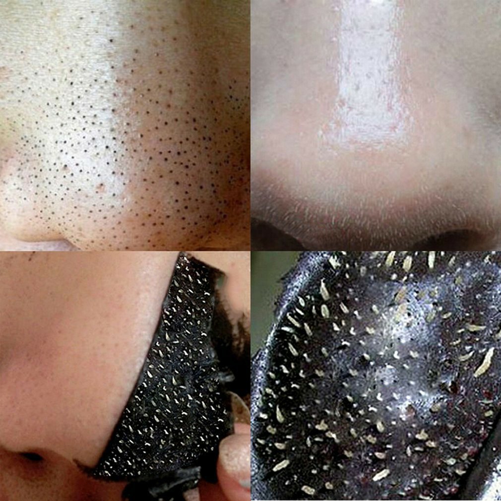 20/30/50PCS Nose Blackhead Remover Mask Deep Cleansing Skin Care Shrink Pore Acne Treatment Mask Nose Black dots Pore Clean Strips