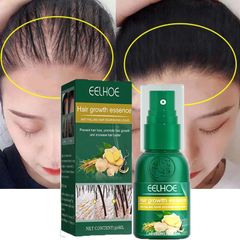 New Ginger Hair Growth Spray Products Natural Anti Hair Loss Serum Prevent Baldness Treatment Fast Grows Nourish Damaged Hair Care as picture 30ml