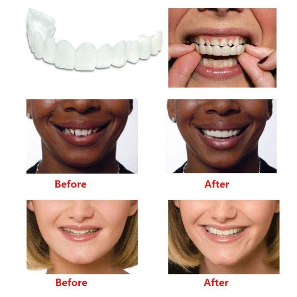 Snap On Smile - Instant Perfect Smile Clip On Veneers