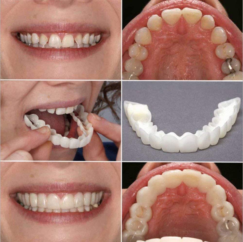 Snap On Smile - Instant Perfect Smile Clip On Veneers