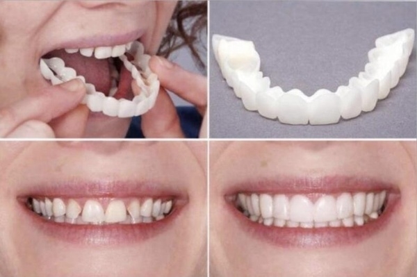 2 Pcs (Upper and Lower) Denture Instant Smile Comfort Fit Flex Cosmetic Teeth Top Cosmetic Veneer