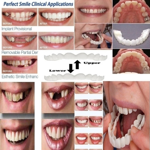2 Pcs (Upper and Lower) Denture Instant Smile Comfort Fit Flex Cosmetic Teeth Top Cosmetic Veneer