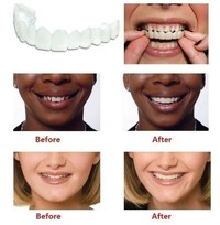 HOT New reusable smile  maxillary teeth  comfort covering instant comfort teeth whitening denture