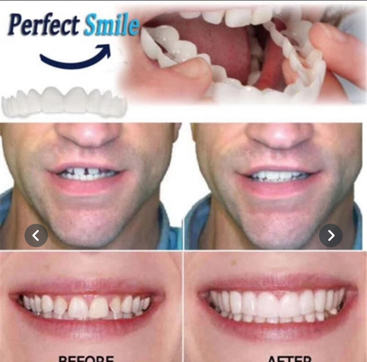 Oral Care Silicone Orthodontic  Dentures Are Suitable for Covering Cosmetic Comfort Whitening Teeth