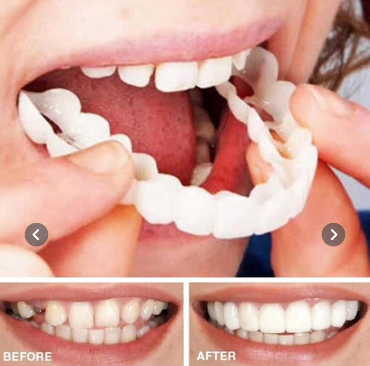 Oral Care Silicone Orthodontic  Dentures Are Suitable for Covering Cosmetic Comfort Whitening Teeth