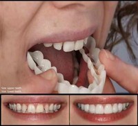 Quality Denture Instant Smile Comfort Fit Flex Cosmetic Teeth Denture Teeth Top Cosmetic Veneer