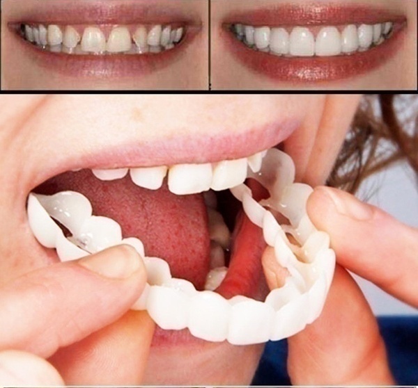 Quality Denture Instant Smile Comfort Fit Flex Cosmetic Teeth Denture Teeth Top Cosmetic Veneer