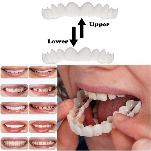 2/4 Pcs Upper and Lower Braces Cosmetic Snap On Instant Perfect Smile Comfort Fit Flex Teeth Veneers