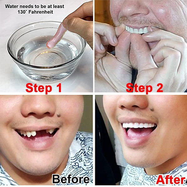 Real Teeth Comfortable and Beautiful Whitening Cosmetics Confidence Dentures Silicone Smiley Veneers
