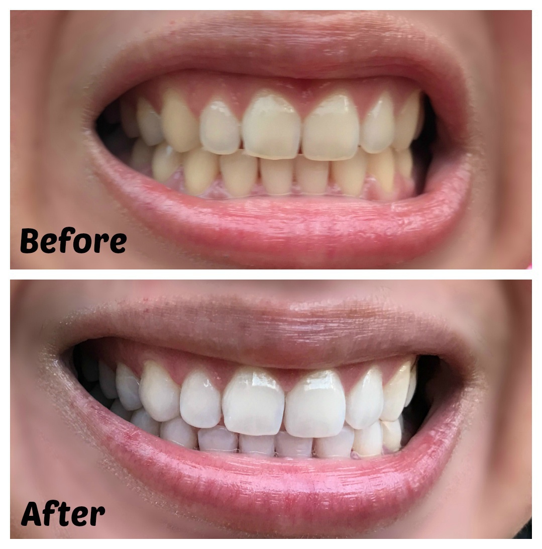 Toothpaste Teeth Whitening Refresh Breath Teeth Cleaning  Oral Care Dental Toothpaste Clean Teeth