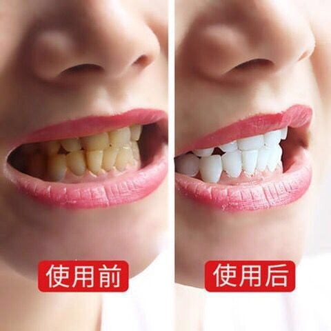 Toothpaste Teeth Whitening Refresh Breath Teeth Cleaning  Oral Care Dental Toothpaste Clean Teeth